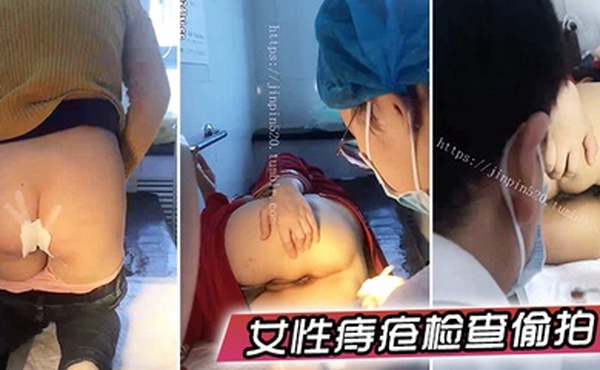女性痔疮检查偷拍国内某小诊所女性痔疮检查治疗多位大屁股女性被偸拍大夫居然是男的一指使劲往菊花里捅紧张的腿直抖紧紧抓着护栏